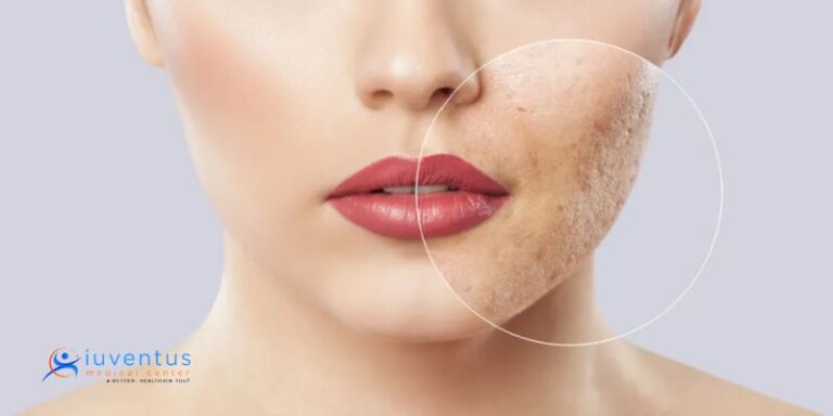 Beyond Botox: PRP Facials and Their Surprising Anti-Aging Benefits