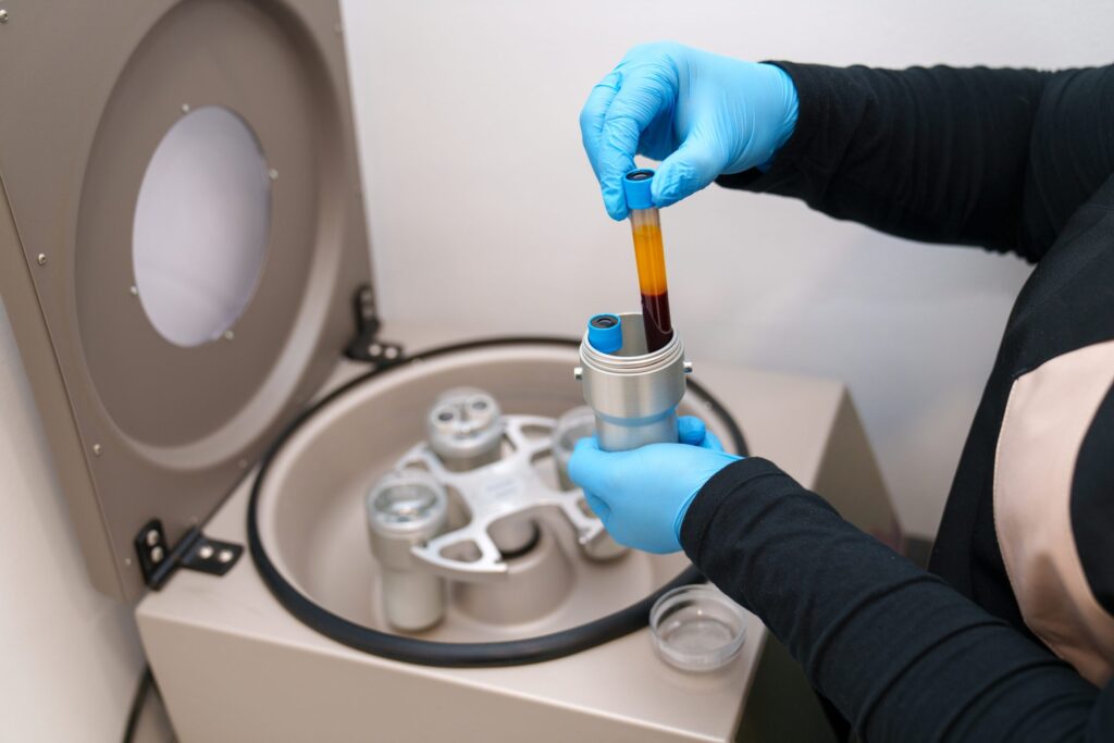 Harnessing the Power of PRP: A Comprehensive Guide to Platelet-Rich Plasma Therapy