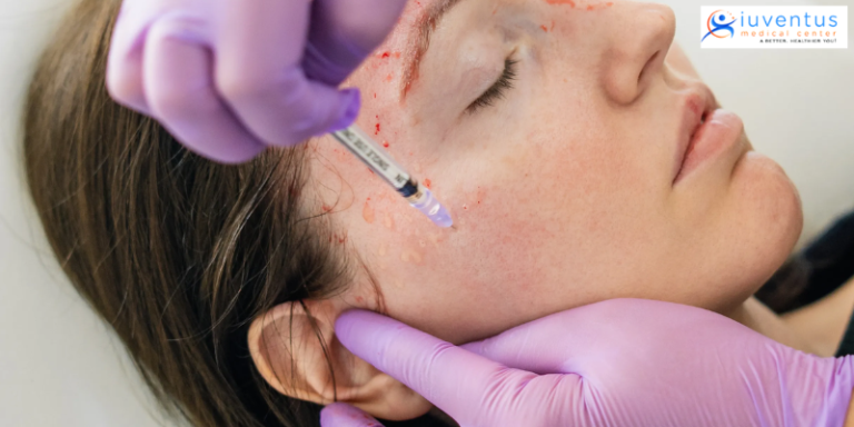 How can you rejuvenate your face with PRP Therapy?