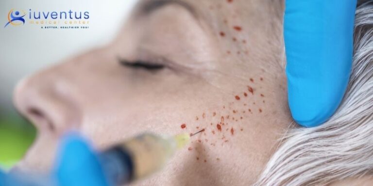 PRP Treatment For Skin Rejuvenation in Las Vegas
