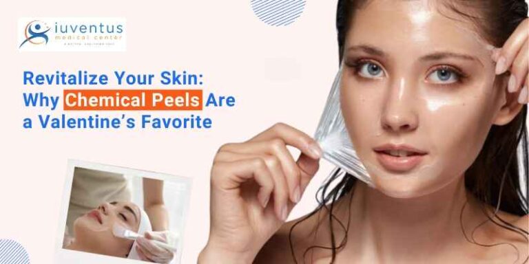 Revitalize Your Skin This Valentine: Why Chemical Peels Are Still a Favorite for Youthful Glow
