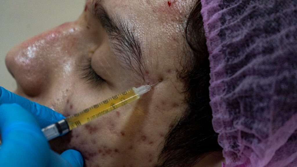 The Dual Wonders of PRP Therapy: Healing Injuries and Revitalizing Skin