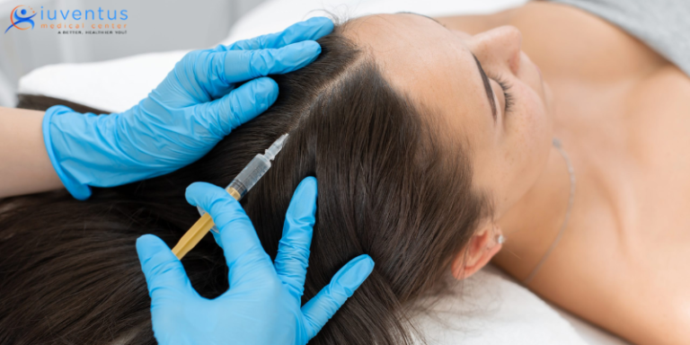 Why PRP Treatment Is Best For Treating Hairfall?